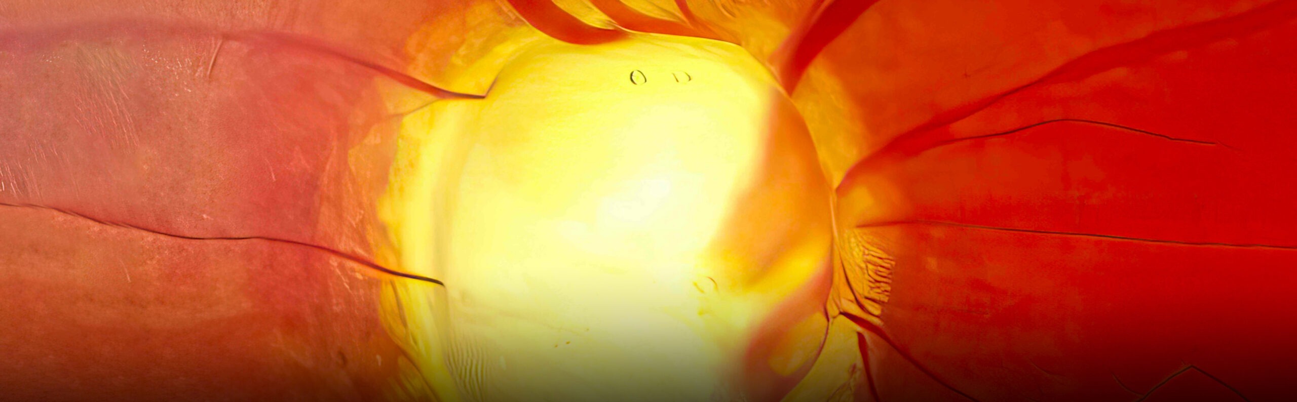 Scientific image of a retina with glaucoma